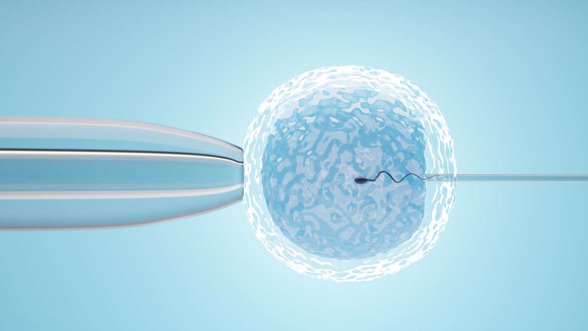 Intracytoplasmic Sperm Injection