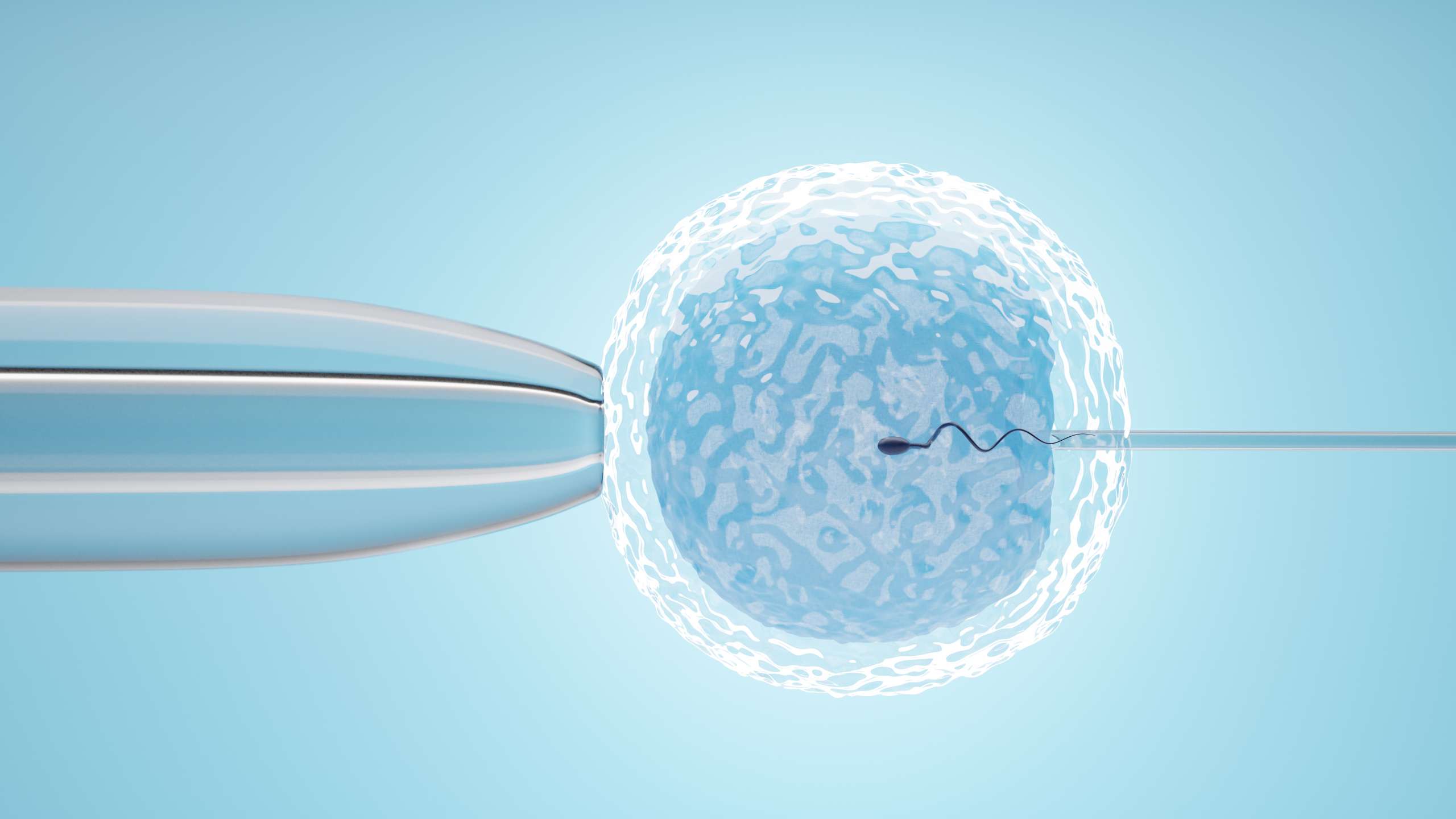 What is Intracytoplasmic Sperm Injection (ICSI)?